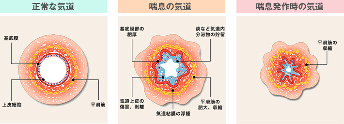 kikan